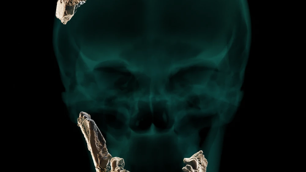 Human Bone, Skull, Nesher-Ramla research team