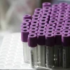 Test tubes for a blood test, illustrative. Photo by Kobi Gideon/Flash90.