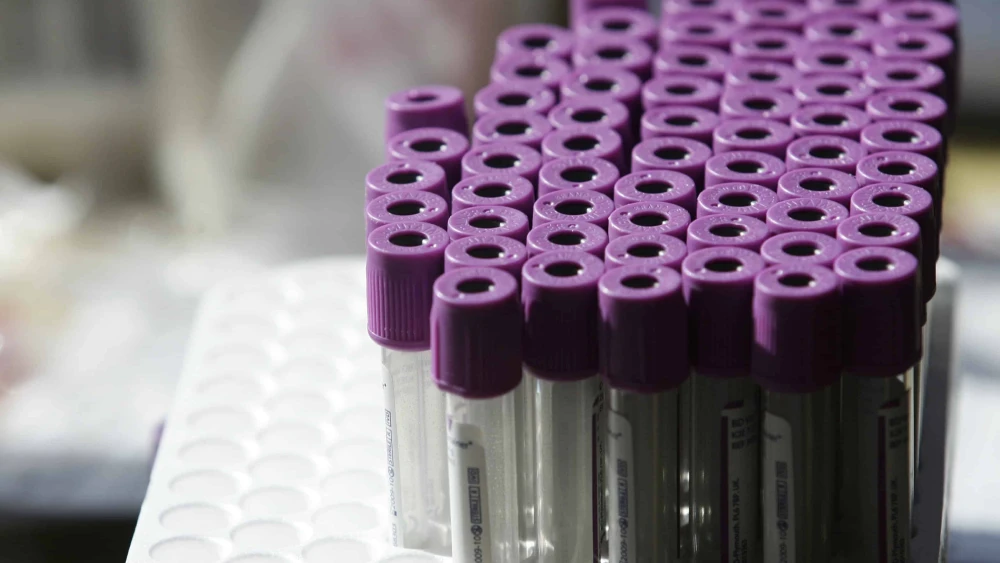 Test tubes for a blood test, illustrative. Photo by Kobi Gideon/Flash90.