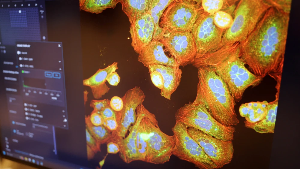 A screen displays an image of the effects of various drugs onto cancer cells from patients, using an automated fluorescence microscope at the High-Throughput Sequencing Platform of the Curie Research Institute in Paris, Dec. 11, 2025. Photo by Thomas Samson/AFP via Getty Images.