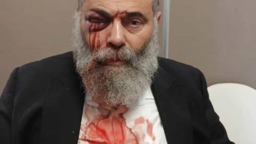 Gilles Cohen, a 67-year-old observant Jew, was attacked on antisemitic grounds on Sep. 27, 2025, in Yerres (Essonne), a suburb south of Paris. Credit: Cohen’s family.