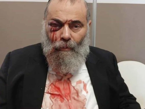 Gilles Cohen, a 67-year-old observant Jew, was attacked on antisemitic grounds on Sep. 27, 2025, in Yerres (Essonne), a suburb south of Paris. Credit: Cohen’s family.