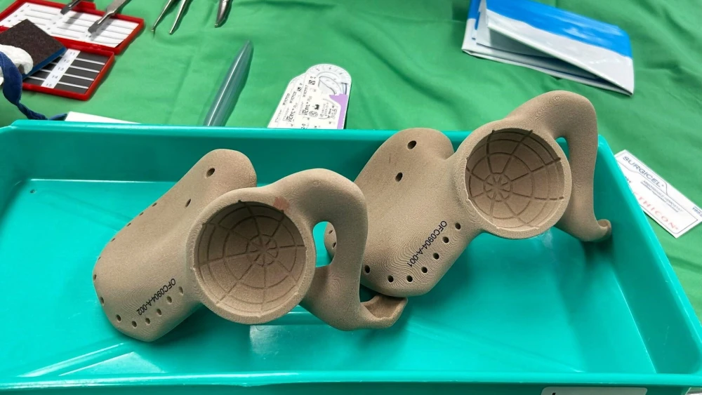 The 3D-printed artificial pelvis. Credit: Clalit Health Services.