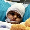 Amina Alhasoni, 7, was critically wounded in Iran's April 13, 2024, missile attack on the Jewish state. Credit: Courtesy.