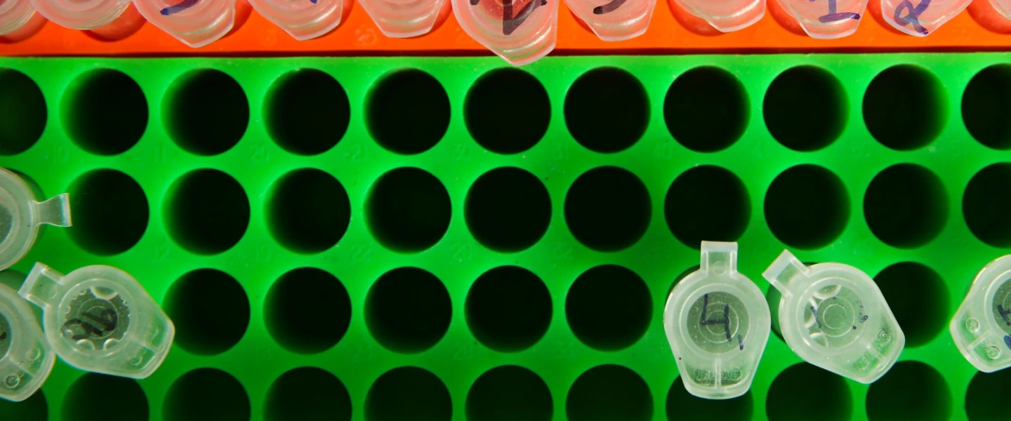 Tubes at a laboratory at Hadassah Hebrew University Medical Center in Jerusalem. Photo by Flash90.
