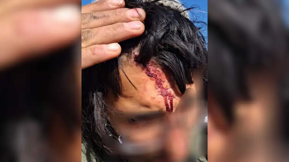 A Jewish shepherd sustained light wounds in a Palestinian assault in the Gush Etzion region of Judea, Jan. 12, 2026. Photo by Hatzalah Judea and Samaria (Rescuers Without Borders).