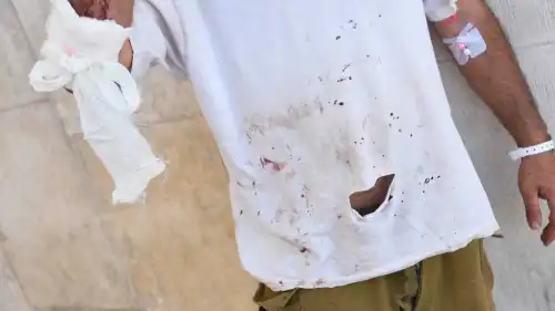 One of the wounded shepherds at Hadassah Medical Center-Mount Scopus in Jerusalem, Aug. 29, 2023. Photo by Yoav Dudkevitch/TPS.