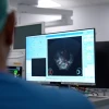 Doctors examine an ultrasound image using new technology at Haifa's Rambam Medical Center, July 15, 2026. Credit: Rambam Medical Center Spokesperson/TPS-IL.