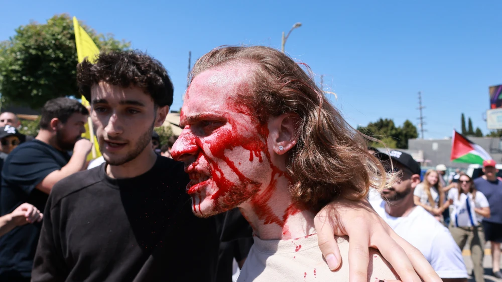 A supporter of Israel with blood on his face, is helped up after clashing with pro-Palestinian protesters blocking access to the Adas Torah Orthodox Jewish synagogue, in Los Angeles, June 23, 2024. (Photo by DAVID SWANSON / AFP) (Photo by DAVID SWANSON/AFP via Getty Images)