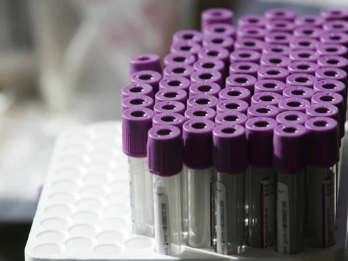 Test tubes for a blood test, illustrative. Photo by Kobi Gideon/Flash90.