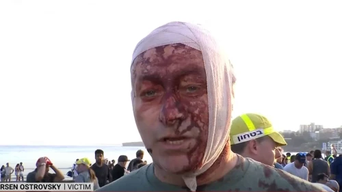 Arsen Ostrovsky, Bondi