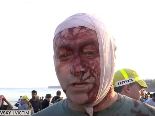 Arsen Ostrovsky, Bondi