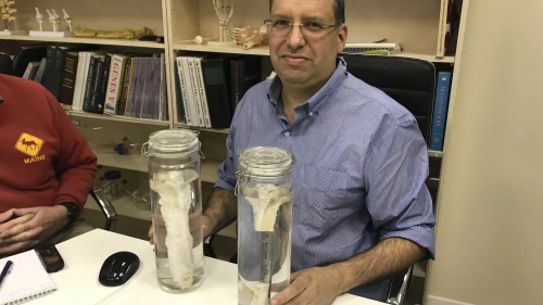 Dr. Shai Meretzki, CEO of Bonus BioGroup, with a lab-grown bone. Credit: Bonus BioGroup.