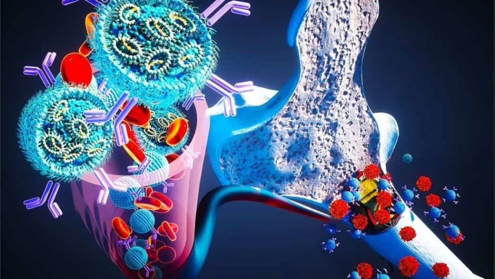 Myeloma, July 30, 2023. Photo by Ella Maru Studio via TPS.