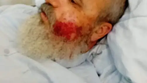 B'Sheva newspaper editor Emmanuel Shiloh recovering at Meir Medical Center in Kfar Saba, July 4, 2023. Source: Twitter.