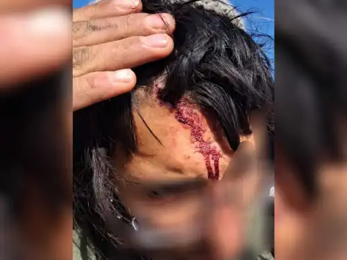 A Jewish shepherd sustained light wounds in a Palestinian assault in the Gush Etzion region of Judea, Jan. 12, 2026. Photo by Hatzalah Judea and Samaria (Rescuers Without Borders).