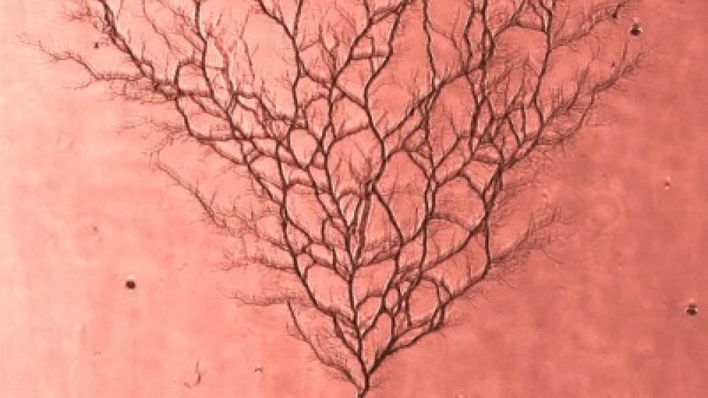 Micro- and nano-fluidic channels in polydimethylsiloxane (PDMS) photographed through an epifluroescence microscope. By Merav Karsenty and Nadya Ostromohov from the Microfluidic Technologies Laboratory headed by assistant professor Moran Bercovici at the Technion Faculty of Mechanical Engineering.