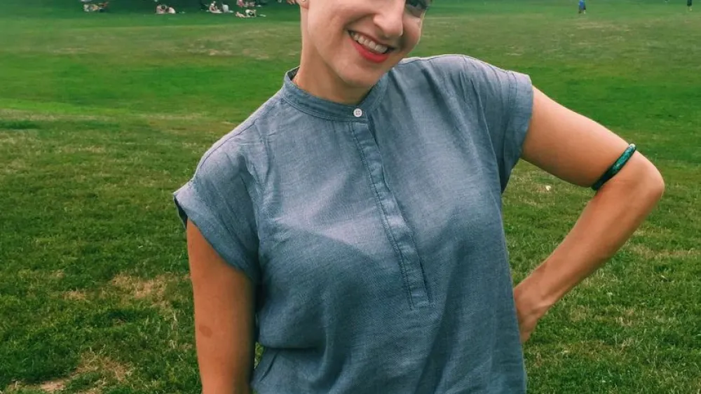 Comedian Chani Lisbon shows her hair loss due to alopecia; it has since grown back. Credit: Courtesy.