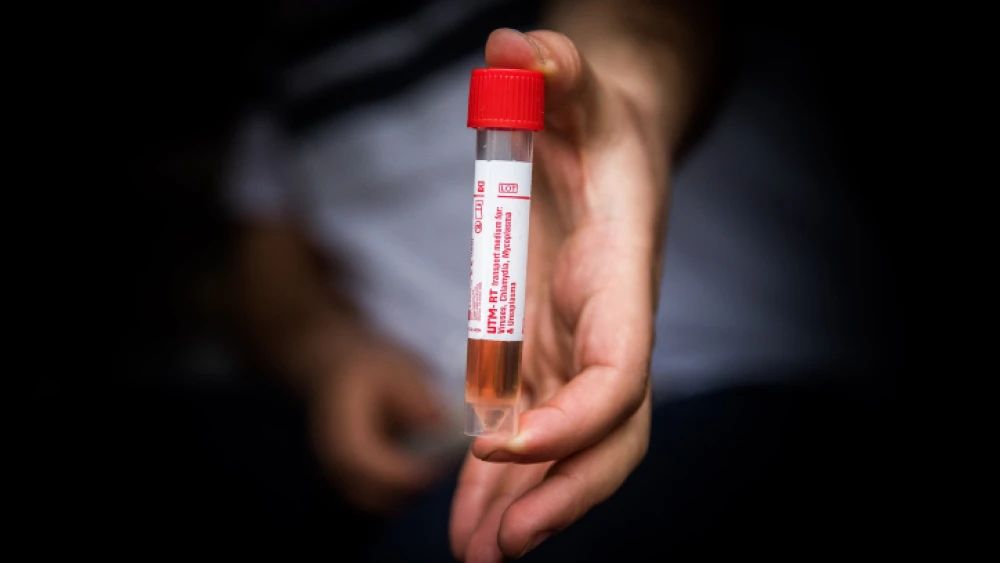 A Magen David Adom worker prepares a COVID-19 test kit in Jerusalem, on March 17, 2020. Photo by Yonatan Sindel/Flash90.