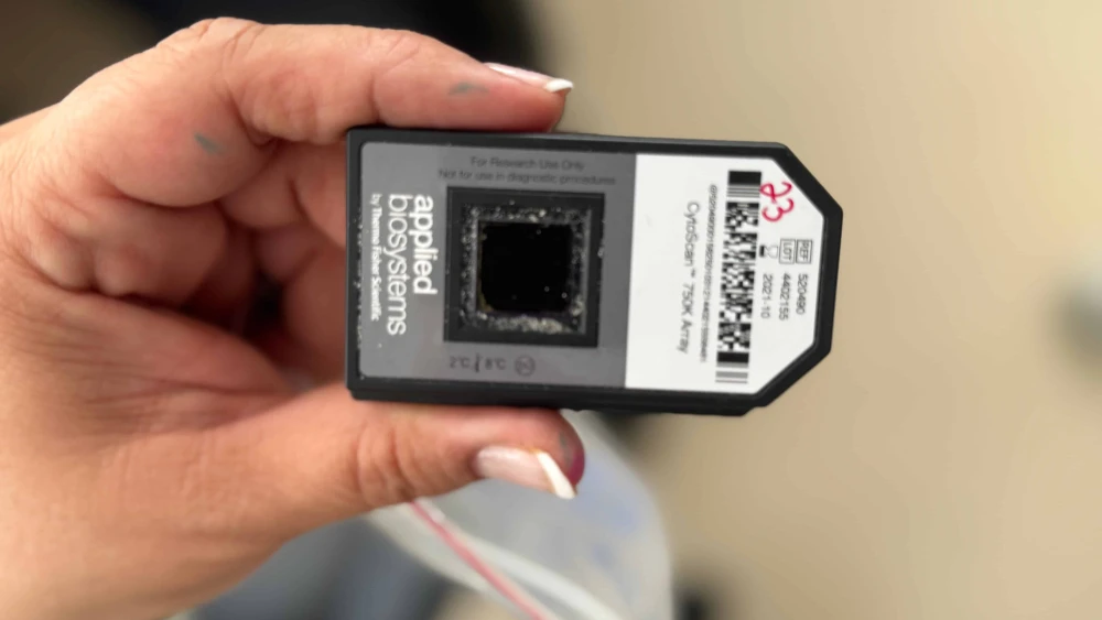 The genetic chip test in Prof. Idit Maya's lab at Rabin Medical Center, Aug. 6, 2025. Photo by Howard Blas.