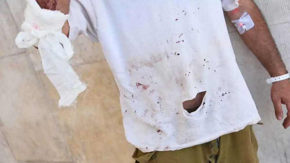One of the wounded shepherds at Hadassah Medical Center-Mount Scopus in Jerusalem, Aug. 29, 2023. Photo by Yoav Dudkevitch/TPS.